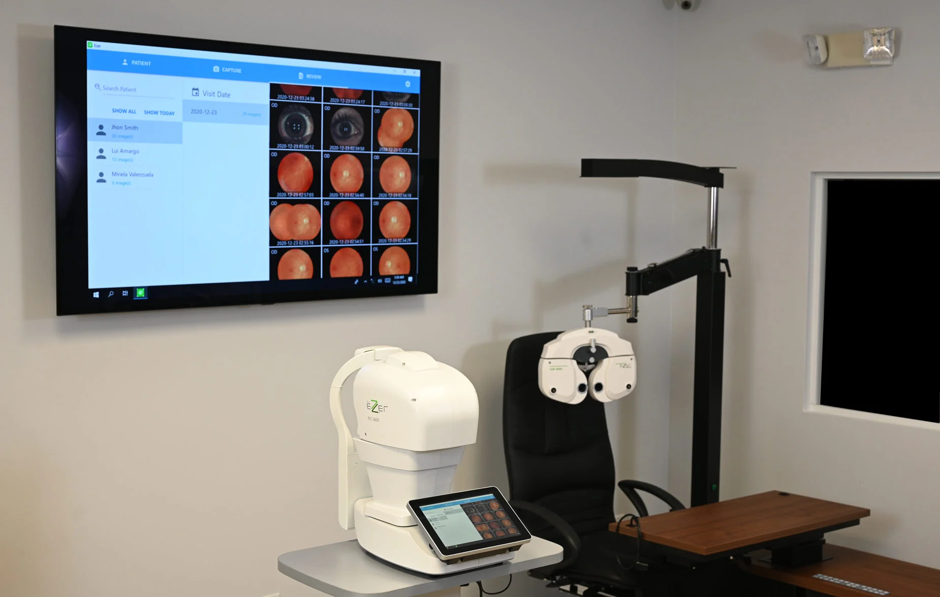 Retinal Cameras